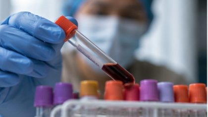 HIV/AIDS hingga TB, ini data kasus penyakit di Blitar